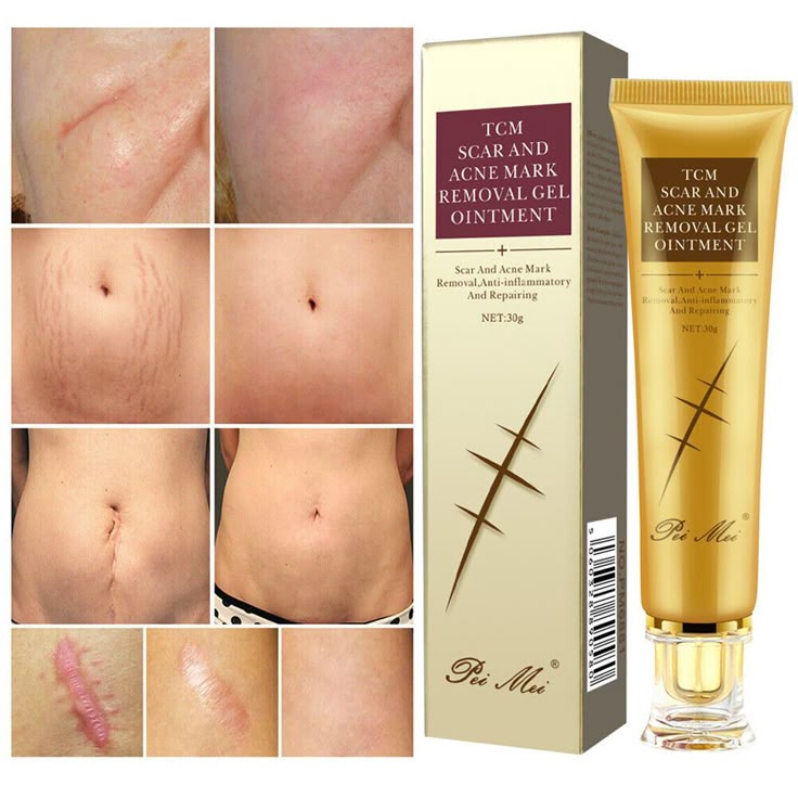 Gel Cosmétique Anti-Cicatrices