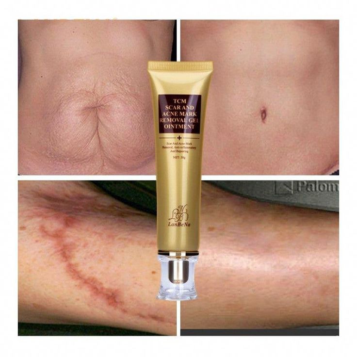 Gel Cosmétique Anti-Cicatrices
